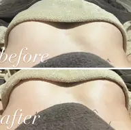 【美乳バストケア】たるみを引き上げるコース✨ 《デコルテの痩せ・たるみ・離れ・左右差などを引き出す!》