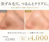 毛穴エクストラクション+美容液パック付