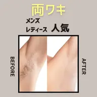 【自己処理だけは黒ずみの元!】 両ワキ