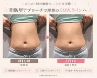 💎上半身集中ボディケアでスッキリ美ラインへ✨