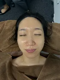 切らないたるみケア【ダーマコア】 Bio Boost➕フラクショナルRF