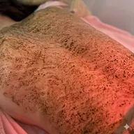【女性限定】背中ハーブピーリング🌿自信の持てる艶肌へ肌質改善✨|毛穴洗浄つき