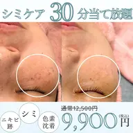 ✨シミ取り30分✨《シミケアプレミアムコース》美容液のエレクトロポレーション導入＋ヘッド・デコルテマッサージ付き！