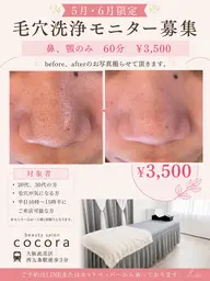 毛穴洗浄(鼻、あご)60分 ¥3500