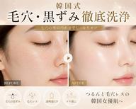 【人気No.1 毛穴・黒ずみ】毛穴洗浄でつるんと素肌へ🫧