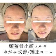 矯正コース【歪み/左右差改善】頭蓋骨小顔コルギ60分