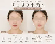 毛穴洗浄×小顔筋膜リリース🌿 小顔筋膜リリースモデル募集✨