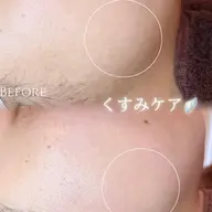 くすみ改善 フェイシャルWAX🪞