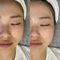 女性限定🚺【6/5(金)12:00~】フルフェイスWax無料レッスンモデル