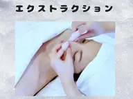 毛穴エクストラクションモンロー式で小鼻の黒ずみ、毛穴洗浄!