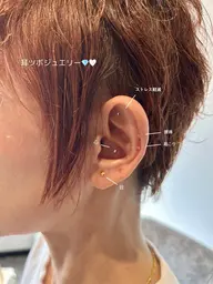 耳ツボつけ放題（カウンセリング込み）