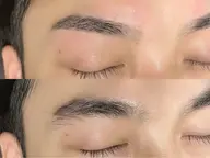 🚹メンズ［眉毛ワックス脱毛]