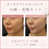 《ツヤ肌×小顔✨》選べるピーリング+オンダリフトの贅沢セット♪