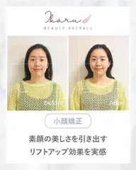 【初回体験】小顔かっさ＋小顔矯正＋ヘッドスパ（40分）  ¥9000→¥6000