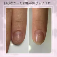 自爪育成🌱1本体験
