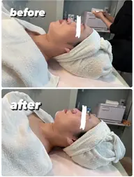 【モニター限定残り4名様❣️】👃毛穴、たるみ引き締め温感石膏マスクエステ💆‍♀️モニター様特別価格💖