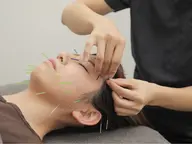 \小顔贅沢コース/【美容鍼灸×デコルテオイルマッサージ】🌟ドライヘッドスパ付き🌟 肌荒れ、むくみ、首肩こりにおすすめ