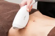 VIO脱毛お試し