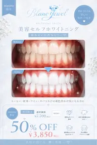 【初回50%OFF💎】美容セルフホワイトニング