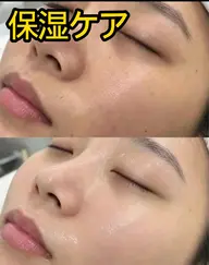 人気💕保湿ケア潤い肌へ💕毛穴洗浄とピーリング込み💕60分¥ 2980