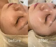 【悩まれたらまずこちら！】陶肌トリートメント💎次世代ハーブピーリング💎(陶肌パウダー2g)