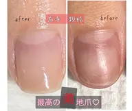 美自爪育成ケア💅コンプレックス解消🤗残席1名❗️3ヶ月間に8回のご来店です。※詳細をご覧ください♡