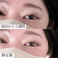 フラットラッシュ100本