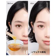 【初回/女性限定】HBL + ワックス脱毛Mini