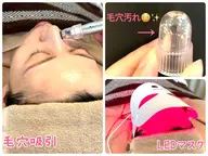 【角栓徹底!!除去💆♀️✨】大人気毛穴洗浄💖ザラつき毛穴を根こそぎ吸引🥺お仕上げのLEDマスクでキメも復活💖