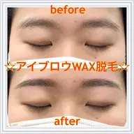 眉毛WAX脱毛