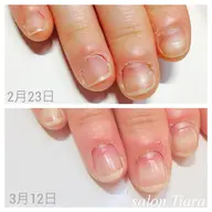 【スカルプ仕上げ自爪育成┊深爪緩和 】最短3ヶ月~で5mm伸びます