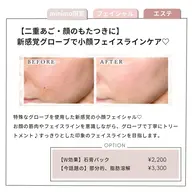 【二重あご・顔のもたつきに】新感覚グローブで小顔フェイスラインケア♡45分