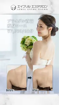 【ブライダル直前の痩身】背中・二の腕スッキリ♪60分集中コース