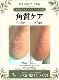 【足裏角質ケア】足裏にできたゴワゴワ角質もスベスベの足裏に✨是非お試しください💁♀️