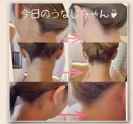うなじ脱毛