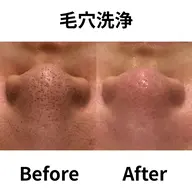 【男女/新規/花粉や皮脂対策で透明肌へ】全顔3D毛穴洗浄 初体験