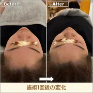 【💎美容整体60分】お顔まわりのケアを中心に◎エラ張りやフェイスラインが気になる方に😌フェイスラインスッキリ✨