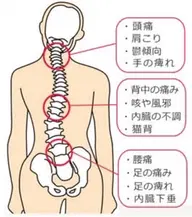 全身ゆがみ矯正施術