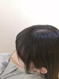 前髪のうねりをなんとかしたい!そんなアナタに。(前髪縮毛+前髪カット)