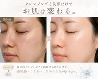 【ドクターリセラ導入💖】変わる洗顔の真実✨プロ直伝・美肌洗顔個別レッスン(あなたに合わせたサンプルお土産付き🎁)