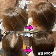ヘア増毛エクステ300本