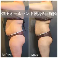 【ミニモ限定】◆28日モニター価格◆慢性疲労/むくみ/だるさ/首肩凝り 全身リンパ120分