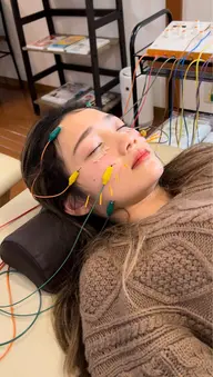 美容鍼