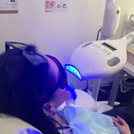 セルフホワイトニング🦷15分×2回🌟
