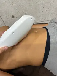 メンズ脱毛  胸からお腹（ヘソ下まで）