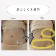 【人気No.1】内側から整う温活コース(よもぎ蒸し+腸もみ)計85分