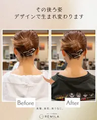 【うなじ脱毛】レミラ　ネープデザイン　初回は¥初回は3500
