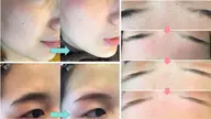 アイブロウワックス【黄金比率を測り、眉周りのみのワックス脱毛】🐣
