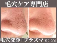 OPEN限定　毛穴洗浄体験【毛穴洗浄＋プラズマ】