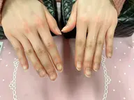 ネイルケア
